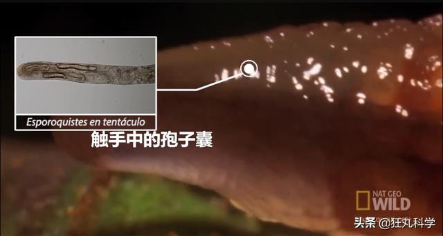 白玉蜗牛寄生虫感染人图片